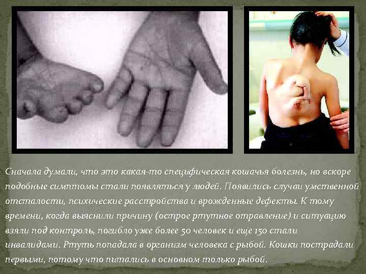  Сначала думали, что это какая-то специфическая кошачья болезнь, но вскоре подобные симптомы стали