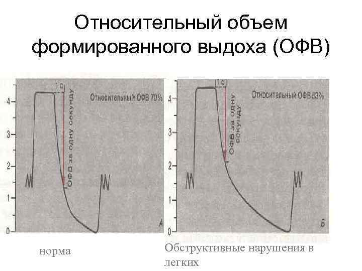 Относительный объем формированного выдоха (ОФВ) норма Обструктивные нарушения в легких 