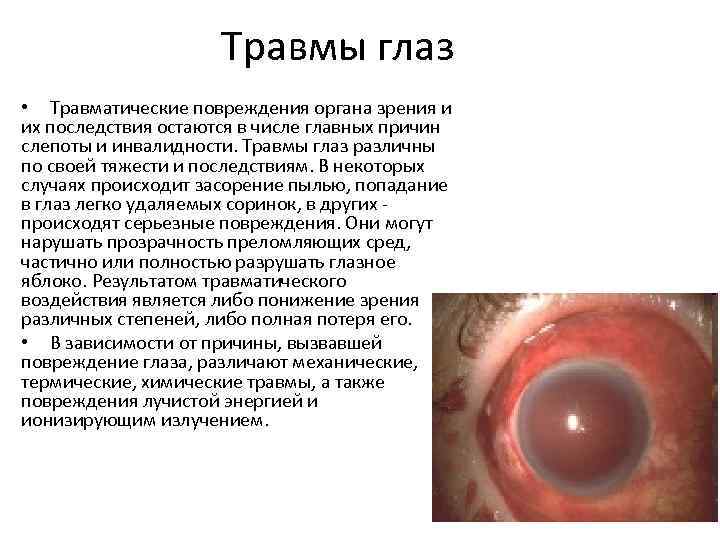 Травмы глаз • Травматические повреждения органа зрения и их последствия остаются в числе главных