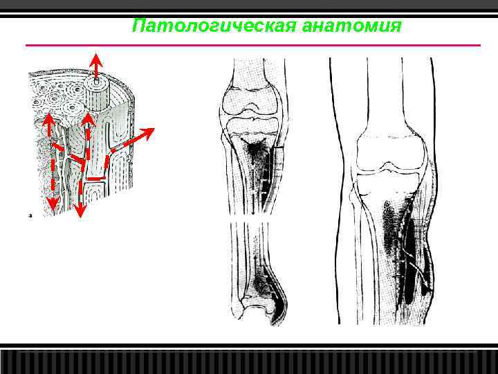 Патологическая анатомия 