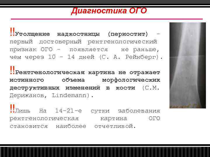 Диагностика ОГО ‼Утолщение надкостницы (периостит) первый достоверный рентгенологический признак ОГО - появляется не раньше,