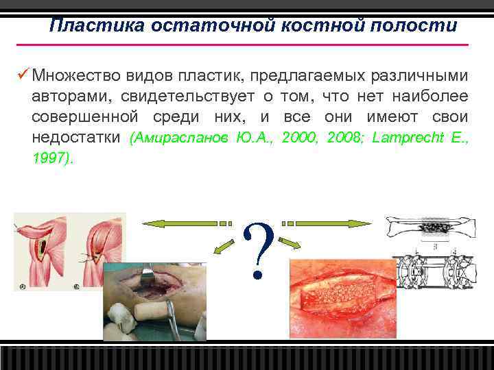 Пластика остаточной костной полости ü Множество видов пластик, предлагаемых различными авторами, свидетельствует о том,