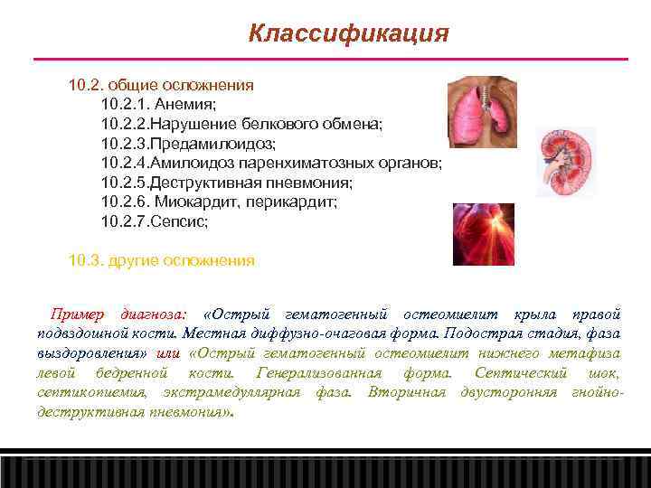 Классификация 10. 2. общие осложнения 10. 2. 1. Анемия; 10. 2. 2. Нарушение белкового