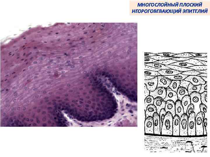 МНОГОСЛОЙНЫЙ ПЛОСКИЙ НЕОРОГОВЕВАЮЩИЙ ЭПИТЕЛИЙ 