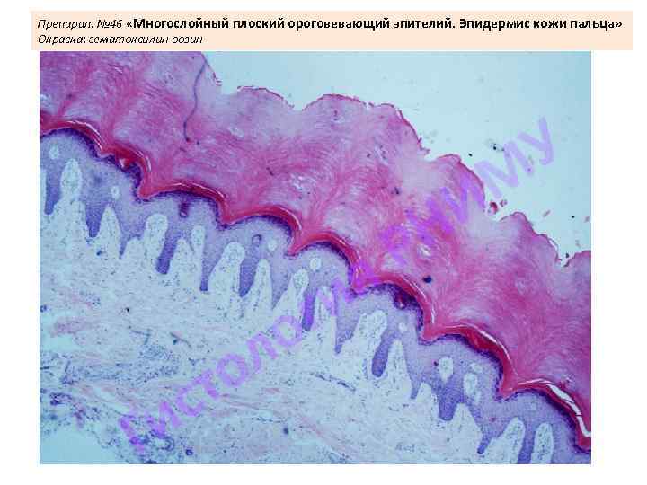 Препарат № 46 «Многослойный плоский ороговевающий эпителий. Эпидермис кожи пальца» Окраска: гематоксилин-эозин 