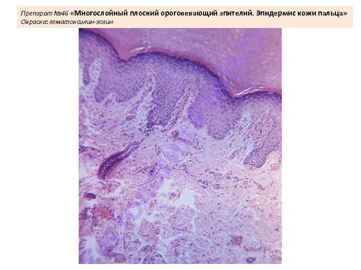Препарат № 46 «Многослойный плоский ороговевающий эпителий. Эпидермис кожи пальца» Окраска: гематоксилин-эозин 