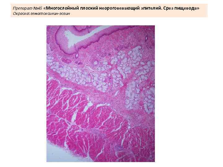 Препарат № 45 «Многослойный плоский неороговевающий эпителий. Срез пищевода» Окраска: гематоксилин-эозин 