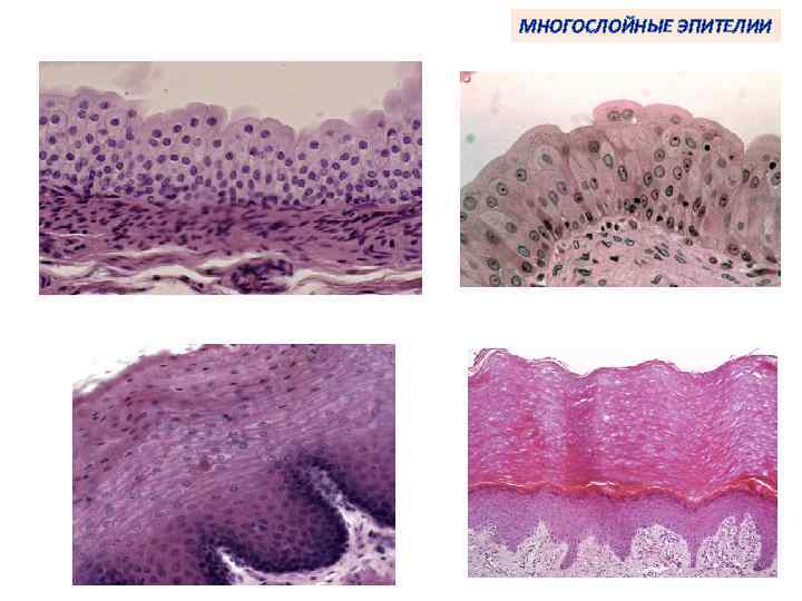 МНОГОСЛОЙНЫЕ ЭПИТЕЛИИ 