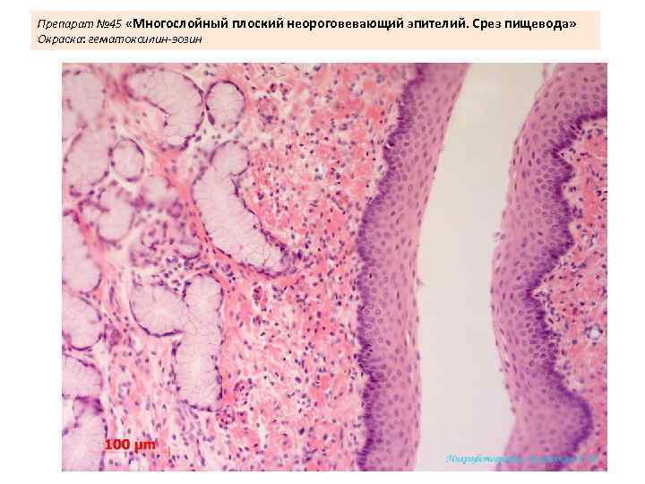 Препарат № 45 «Многослойный плоский неороговевающий эпителий. Срез пищевода» Окраска: гематоксилин-эозин 
