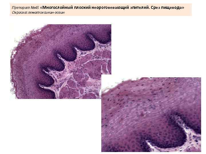 Препарат № 45 «Многослойный плоский неороговевающий эпителий. Срез пищевода» Окраска: гематоксилин-эозин 