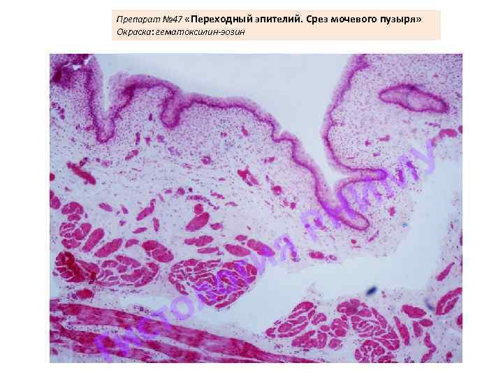 Препарат № 47 «Переходный эпителий. Срез мочевого пузыря» Окраска: гематоксилин-эозин 