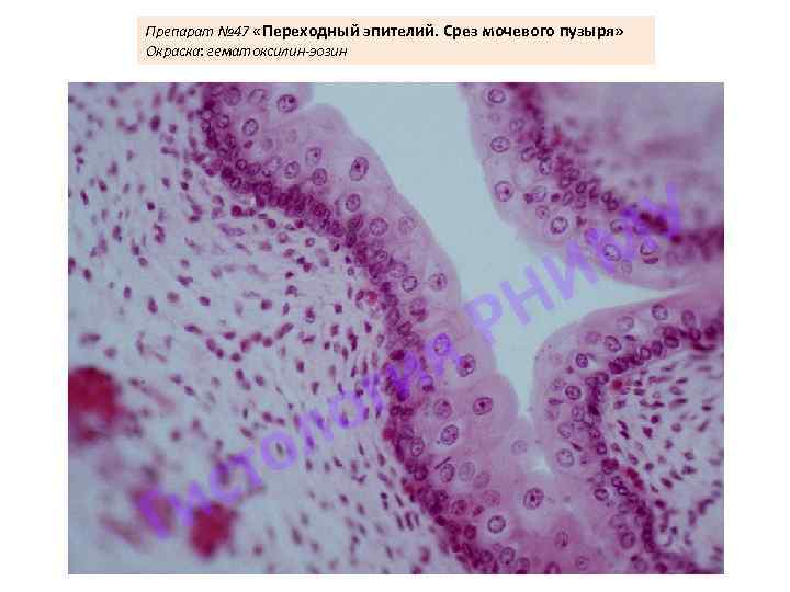 Препарат № 47 «Переходный эпителий. Срез мочевого пузыря» Окраска: гематоксилин-эозин 