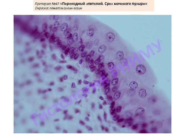 Препарат № 47 «Переходный эпителий. Срез мочевого пузыря» Окраска: гематоксилин-эозин 