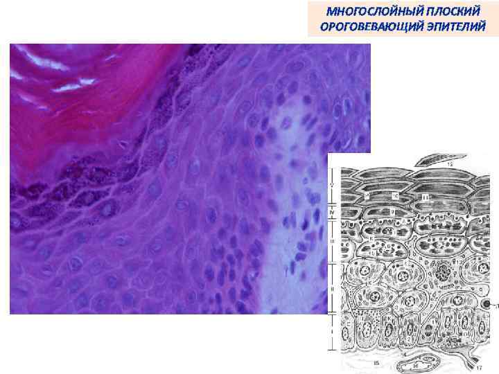 МНОГОСЛОЙНЫЙ ПЛОСКИЙ ОРОГОВЕВАЮЩИЙ ЭПИТЕЛИЙ 