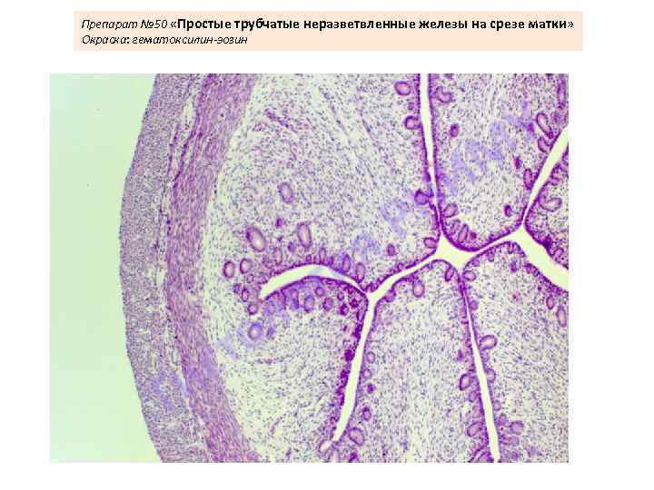 Препарат № 50 «Простые трубчатые неразветвленные железы на срезе матки» Окраска: гематоксилин-эозин 
