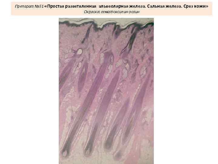 Препарат № 51 «Простая разветвленная альвеолярная железа. Сальная железа. Срез кожи» Окраска: гематоксилин-эозин 