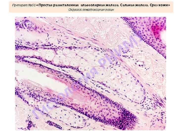 Препарат № 51 «Простая разветвленная альвеолярная железа. Сальная железа. Срез кожи» Окраска: гематоксилин-эозин 
