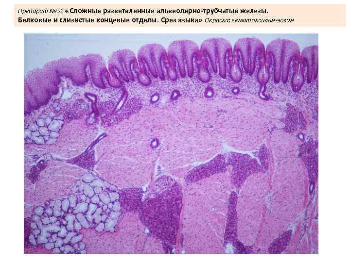 Препарат № 52 «Сложные разветвленные альвеолярно-трубчатые железы. Белковые и слизистые концевые отделы. Срез языка»