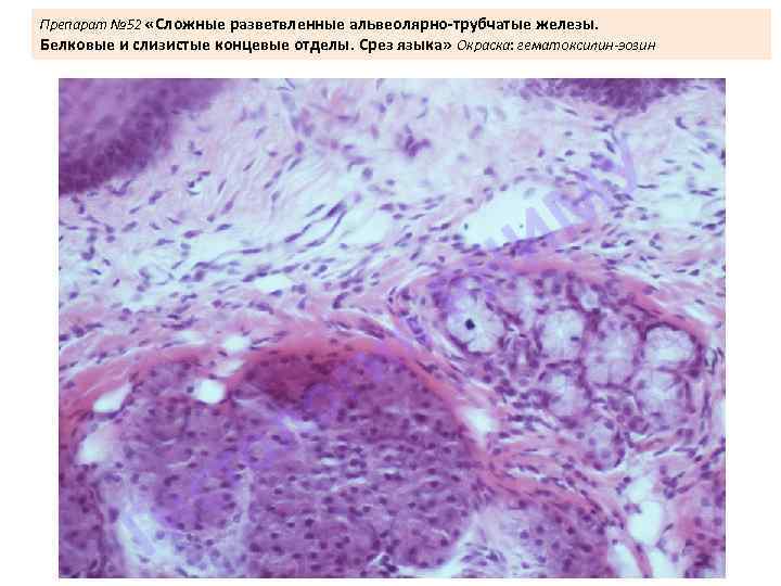 Препарат № 52 «Сложные разветвленные альвеолярно-трубчатые железы. Белковые и слизистые концевые отделы. Срез языка»