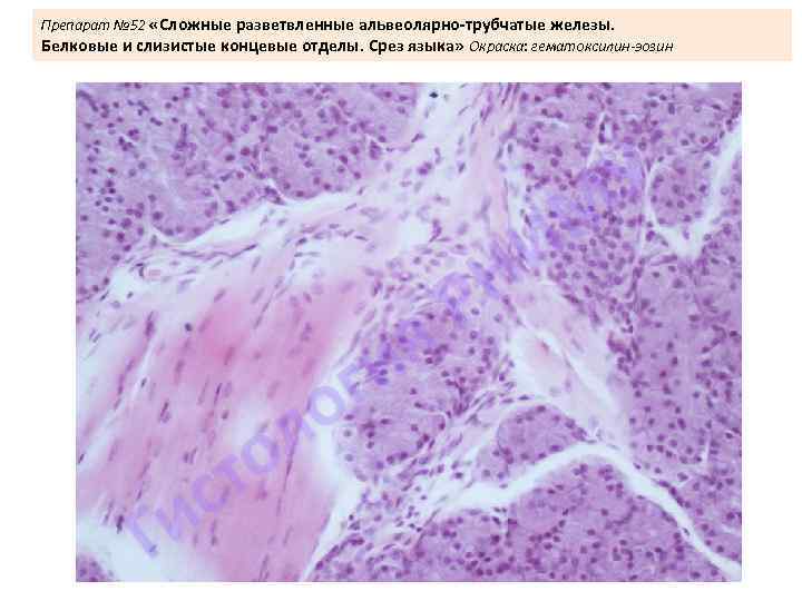 Препарат № 52 «Сложные разветвленные альвеолярно-трубчатые железы. Белковые и слизистые концевые отделы. Срез языка»