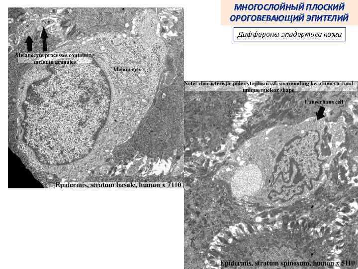 МНОГОСЛОЙНЫЙ ПЛОСКИЙ ОРОГОВЕВАЮЩИЙ ЭПИТЕЛИЙ Диффероны эпидермиса кожи 