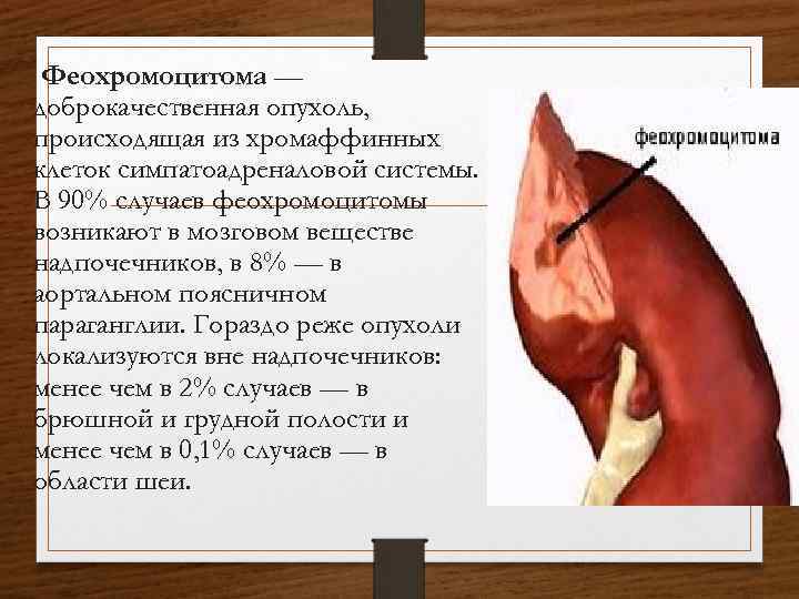 Феохромоцитома — доброкачественная опухоль, происходящая из хромаффинных клеток симпатоадреналовой системы. В 90% случаев феохромоцитомы
