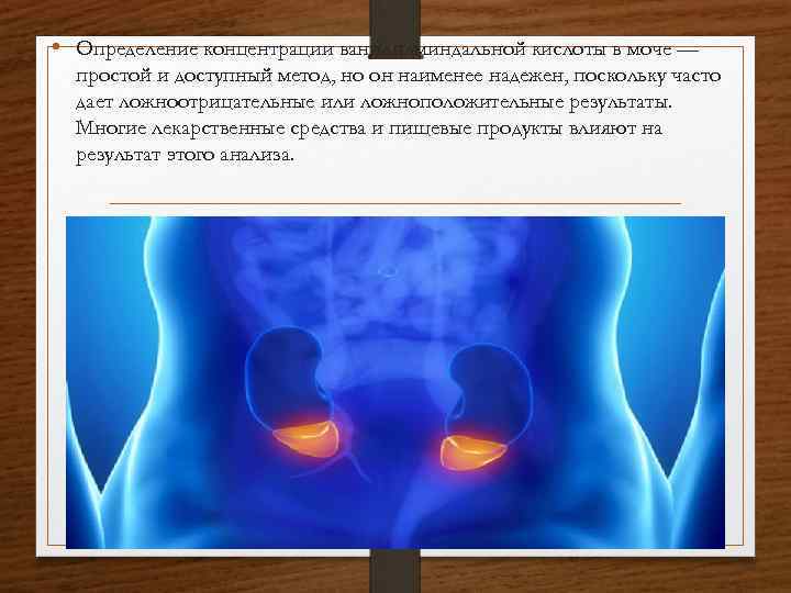 • Определение концентрации ванилилминдальной кислоты в моче — простой и доступный метод, но