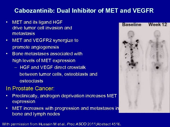 Cabozantinib: Dual Inhibitor of MET and VEGFR • MET and its ligand HGF drive