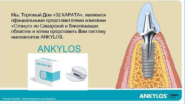 Концепция максимальной протекции тканей (Tissue Care) имплантатов Ankylos Мы, Торговый Дом « 32 КАРАТА»