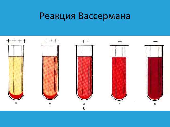 Реакция Вассермана 