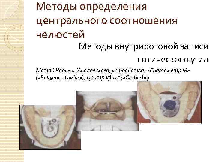Методы определения центрального соотношения челюстей Методы внутриротовой записи готического угла Метод Черных-Хмелевского, устройства: «Гнатометр