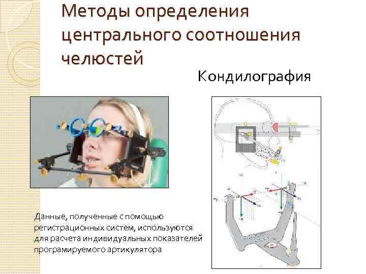 Методы определения центрального соотношения челюстей Кондилография Данные, полученные с помощью регистрационных систем, используются для