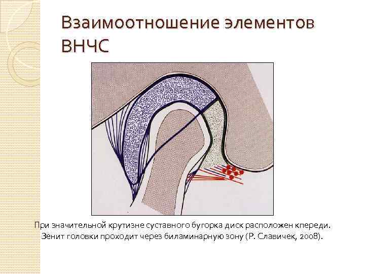 Взаимоотношение элементов ВНЧС При значительной крутизне суставного бугорка диск расположен кпереди. Зенит головки проходит