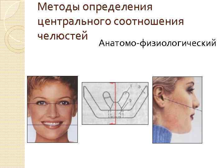 Методы определения центрального соотношения челюстей Анатомо-физиологический 