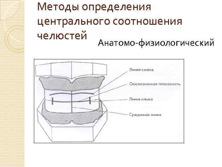 Методы определения центрального соотношения челюстей Анатомо-физиологический 