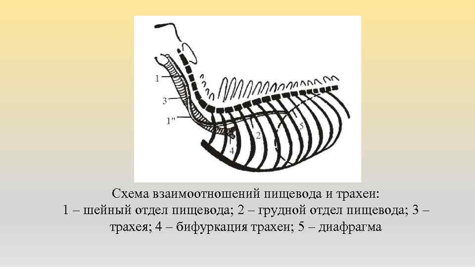 Схема взаимоотношений пищевода и трахеи: 1 – шейный отдел пищевода; 2 – грудной отдел