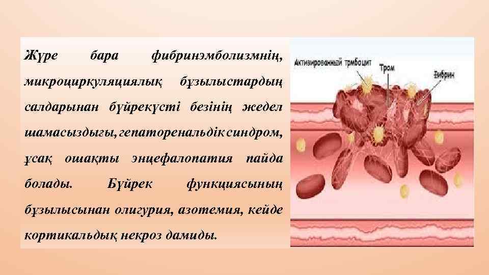 Жүре бара фибринэмболизмнің, микроциркуляциялық бұзылыстардың салдарынан бүйрекүсті безінің жедел шамасыздығы, гепаторенальдік синдром, ұсақ ошақты