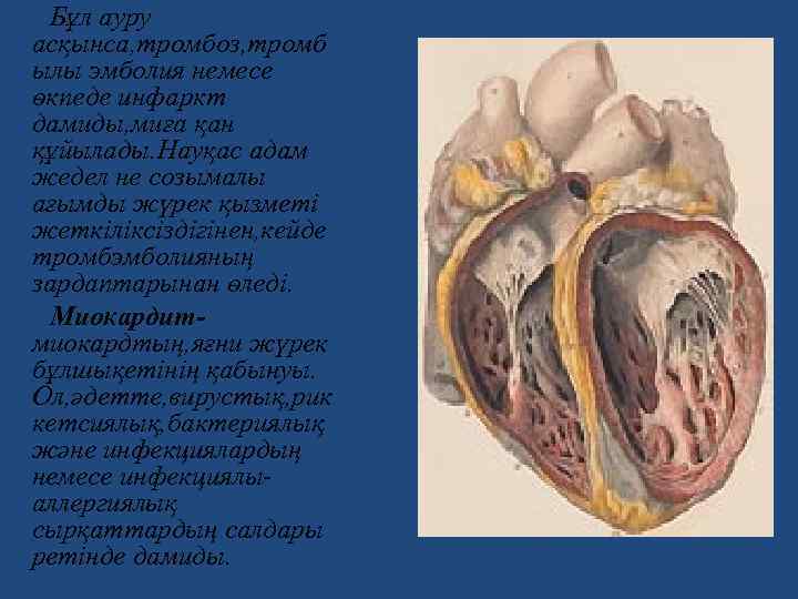 Бұл ауру асқынса, тромбоз, тромб ылы эмболия немесе өкпеде инфаркт дамиды, миға қан құйылады.