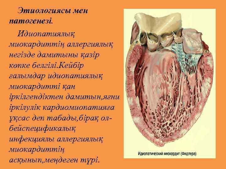 Этиологиясы мен патогенезі. Идиопатиялық миокардиттің аллергиялық негізде дамитыны қазір көпке белгілі. Кейбір ғалымдар идиопатиялық