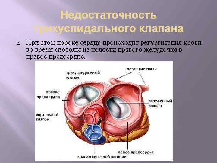 Презентация на тему приобретенный порок сердца