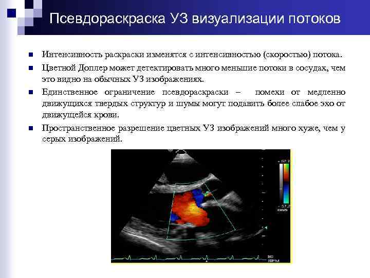 Псевдораска УЗ визуализации потоков n n Интенсивность раски изменятся с интенсивностью (скоростью) потока. Цветной