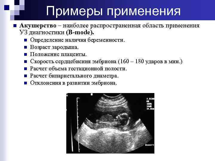 Примеры применения n Акушерство – наиболее распространенная область применения УЗ диагностики (B-mode). n n