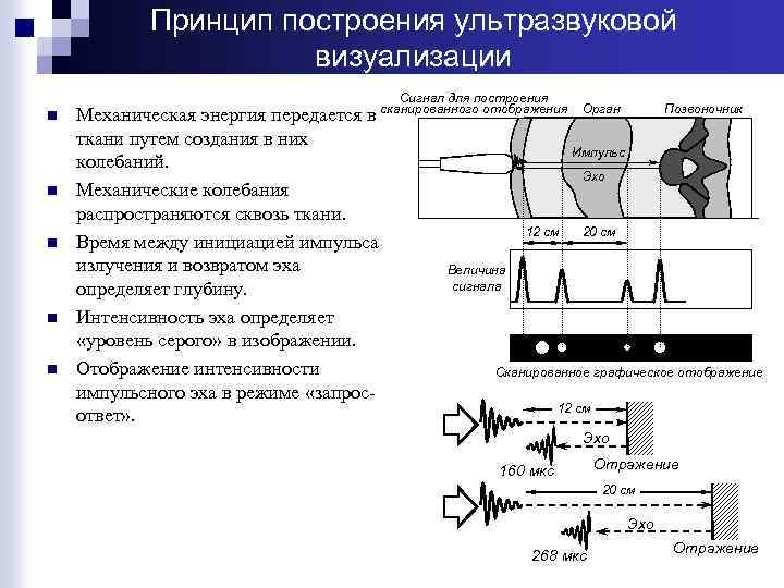 Сравнение ультразвуковых датчиков