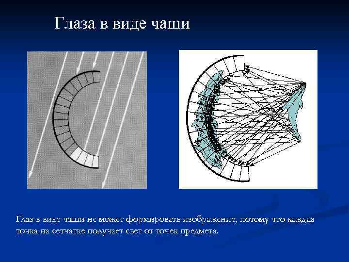 Глаза в виде чаши Глаз в виде чаши не может формировать изображение, потому что