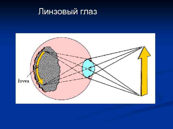 Линзовый глаз 