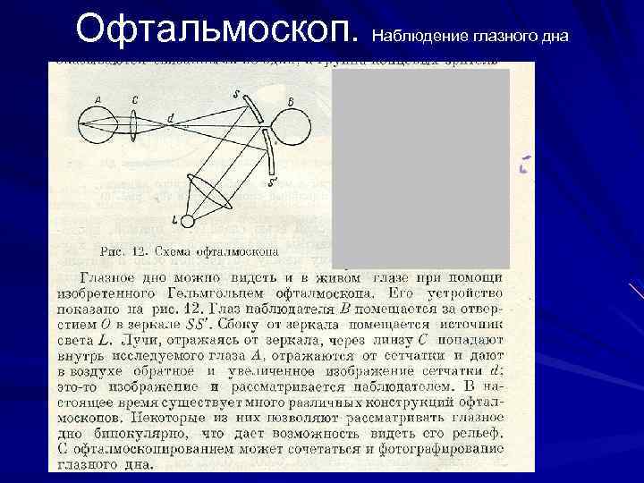 Офтальмоскоп. Наблюдение глазного дна 