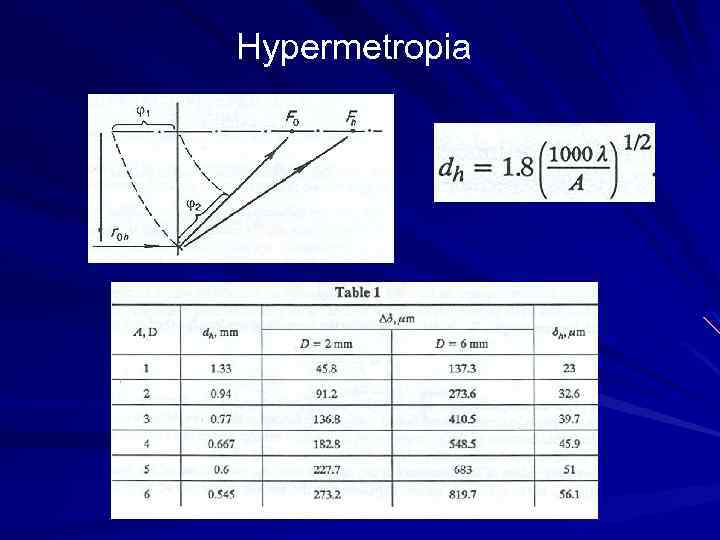 Hypermetropia 