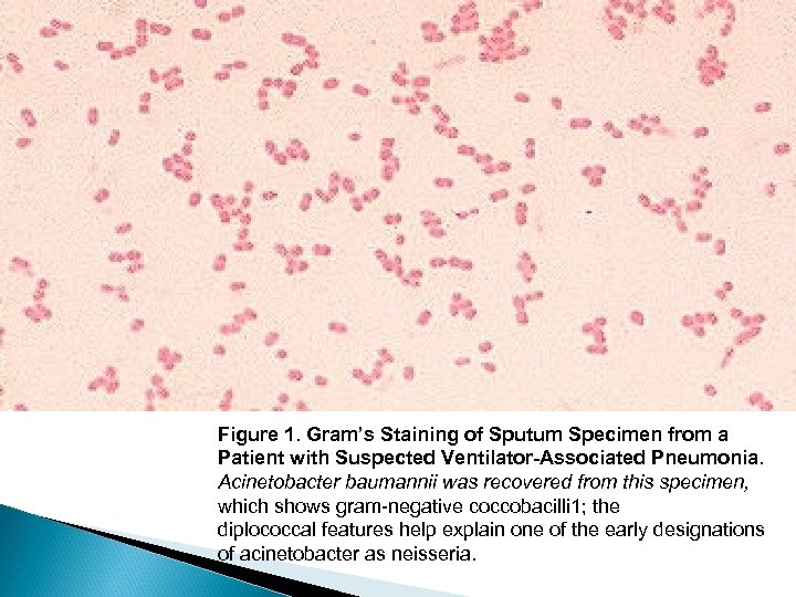 Figure 1. Gram’s Staining of Sputum Specimen from a Patient with Suspected Ventilator-Associated Pneumonia.