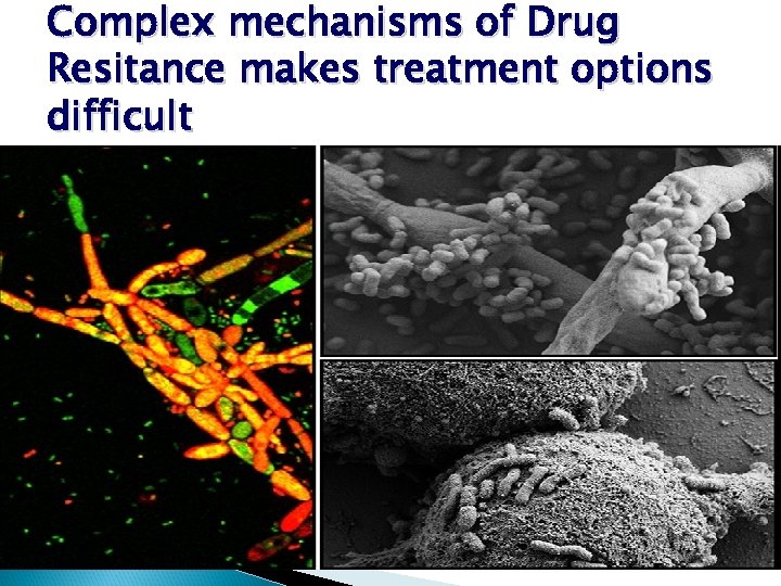 Complex mechanisms of Drug Resitance makes treatment options difficult 