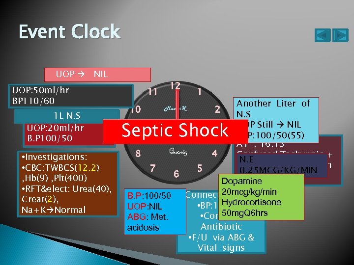 Event Clock UOP NIL UOP: 50 ml/hr BP 110/60 1 L N. S UOP: